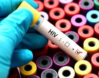‘Türkiye’de HIV pozitif birey sayısının 50 binleri geçtiğini düşünüyoruz’