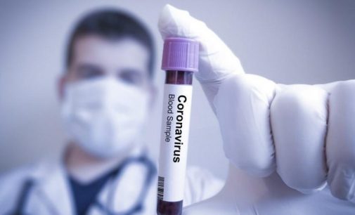 ABD’de ‘kökeni bilinmeyen’ ilk koronavirüs vakası tespit edildi