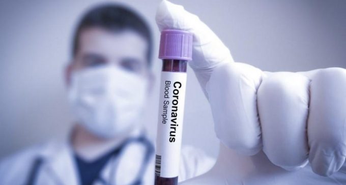 ABD’de ‘kökeni bilinmeyen’ ilk koronavirüs vakası tespit edildi