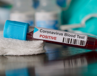 Türkiye’nin bir komşusunda daha koronavirüs vakası tespit edildi