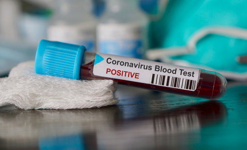 Türkiye’nin bir komşusunda daha koronavirüs vakası tespit edildi