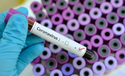 Koronavirüste en erken tanı: Yeni doğan bebekte tespit edildi