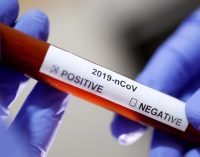 Haftalık koronavirüs tablosu açıklandı: 22 bin 887 vaka, 64 can kaybı