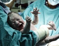 ‘Sezaryen doğum’ oranlarındaki artış sürüyor: Dünya birincisiyiz