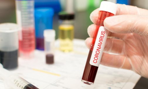 Rusya duyurdu: Koronavirüsü tedavi edecek ilaç geliştirildi