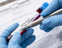 Türkiye’de koronavirüs: Can kaybı 75’e, vaka sayısı 3 bin 629’a yükseldi