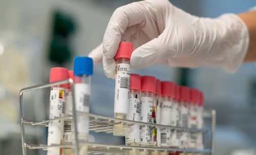 Türkiye, dağıtmaya devam ediyor: Kolombiya’ya 26 bin koronavirüs testi gönderildi