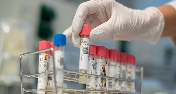 Türkiye, dağıtmaya devam ediyor: Kolombiya’ya 26 bin koronavirüs testi gönderildi