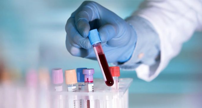 Bilim insanları, hangi kan grubunun koronavirüse karşı daha hassas olduğunu araştırdı