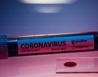 Türkiye’de hangi hastanelerde koronavirüs testi yapılıyor?