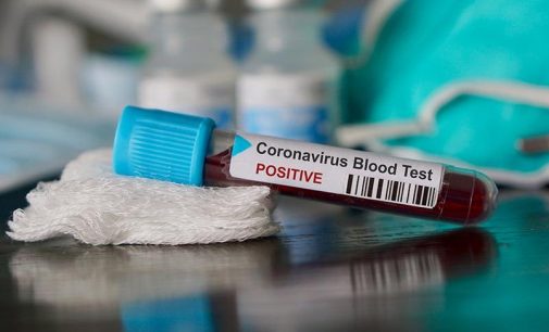ABD’de koronavirüs nedeniyle ölenlerin sayısı 71 oldu