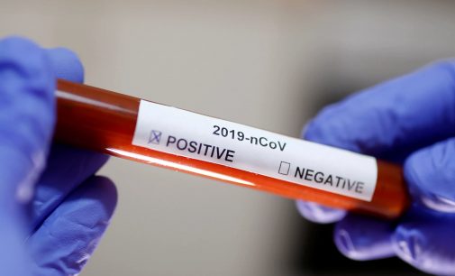 Türkiye’de kaç kişiye koronavirüs testi yapıldı?