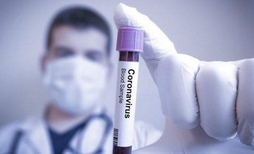 Fransa’da koronavirüs nedeniyle yaşamını yitirenlerin sayısı 33’e yükseldi