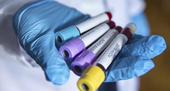 İran’da 23 milletvekilinde koronavirüs tespit edildi
