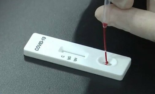 ‘Çin’den iki milyon koronavirüs test kiti gelecek’