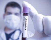 Türk Tabipleri Birliği: ‘Yerli’ koronavirüs testinde bir sıkıntı mı var?