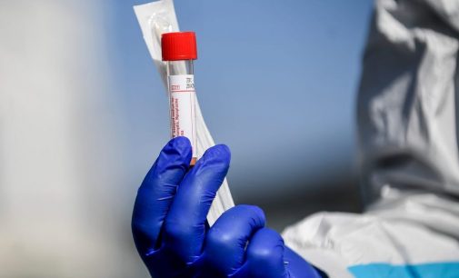 Rusya’da ‘evde koronavirüs testi’ uygulaması başlıyor