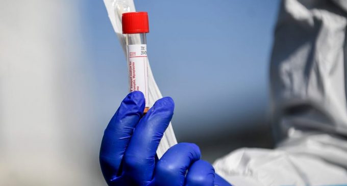 Rusya’da ‘evde koronavirüs testi’ uygulaması başlıyor