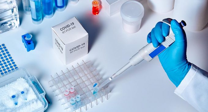 Koronavirüs test bilgilerini bakanlığa vermeyen özel laboratuvar hakkında suç duyurusu