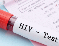 ‘Koronavirüse karşı alınan önlemler AIDS hastalarının artışına neden olabilir’