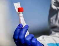Trump: Covid-19 aşısı yıl sonunda elimizde olabilir