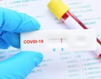 Yüzde 99 doğruluk payı olan Covid-19 antikor testine FDA’dan onay