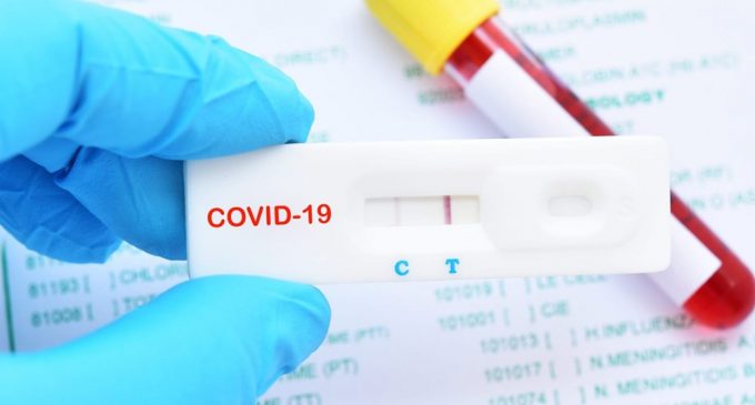 Yüzde 99 doğruluk payı olan Covid-19 antikor testine FDA’dan onay