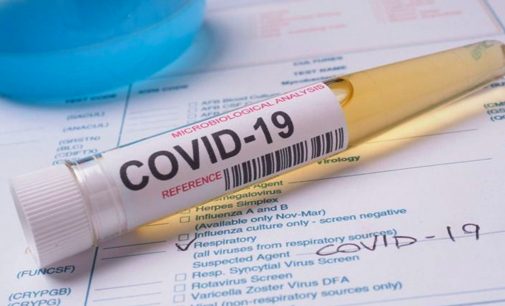 Covid-19 antikor tedavisinde önemli aşama: ‘Hastalığın ilk evresinde olumlu sonuç veriyor’