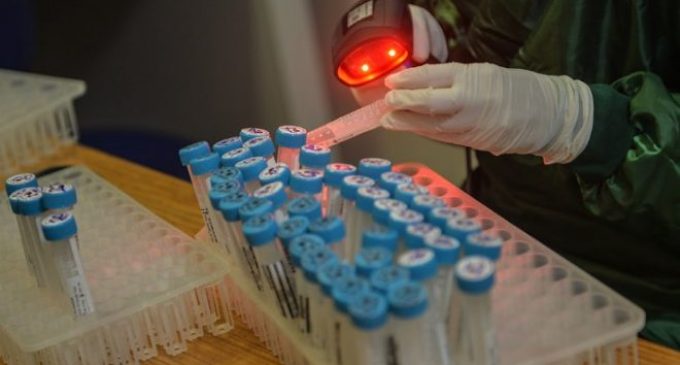 Antikor testleri başladı: 20 Haziran’da İstanbul’un bağışıklık oranı belli olacak