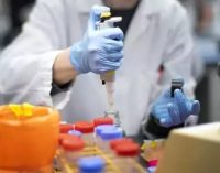 Koronavirüsle ilgili önemli iddia: ‘Bakanlık tek şirketle çalışıyor, şirketin testlerinin doğruluk oranı yüzde 40’