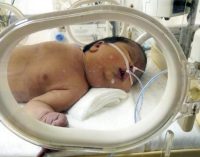 Doğum raporunda erkek olan bebek kız çıktı: Nüfus cüzdanı çıkaran aile hastaneden şikayetçi oldu