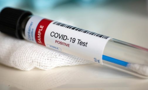Koronavirüs vakalarında artış: Hakime test var, personele yok