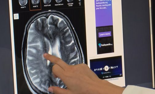 Bilim insanları araştırdı: Covid-19’lu hastaların beyin fonksiyonlarında değişiklik görüldü