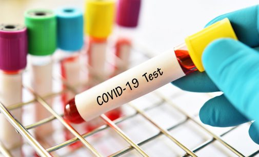 Sağlık Bakanlığı’ndan PCR testleri için yeni düzenleme