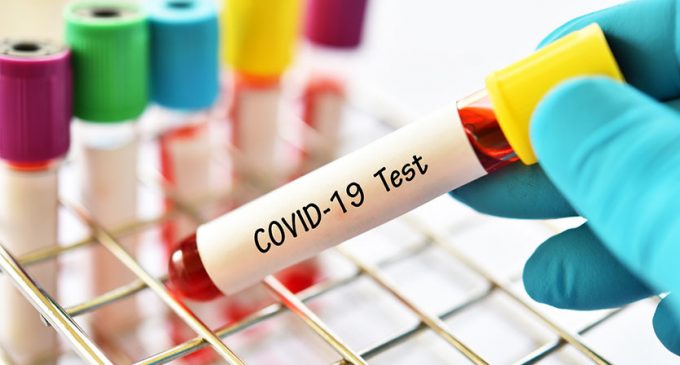 TTB: Evinde Covid-19 hastası olanlara bile “temaslı değil” gerekçesiyle test yapılmadı
