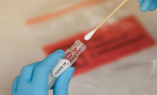 Çin’de artık anüsten alınan örneklerle de koronavirüs testi yapılacak