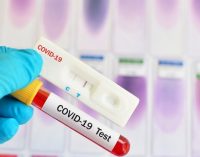 Koronavirüs tanı kitlerinde yeni dönem: PCR testlerinin doğruluk oranı yükselecek