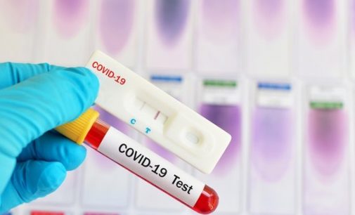 Koronavirüs testlerinde aşı etkisi: Pozitiflik oranında düşüş var