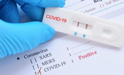 Uzmanlar evde yapılan koronavirüs testleri konusunda uyardı: Güvenilir değil