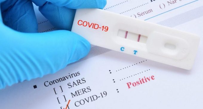 Uzmanlar evde yapılan koronavirüs testleri konusunda uyardı: Güvenilir değil