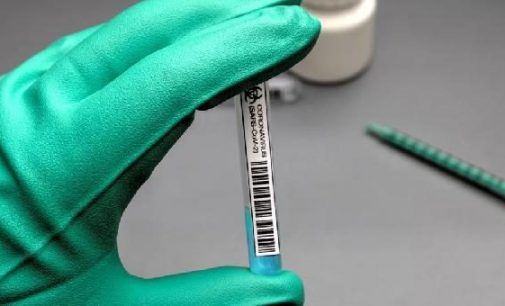 BioNTech ve Pfizer’in geliştirdiği koronavirüs aşısının fiyatı belli oldu