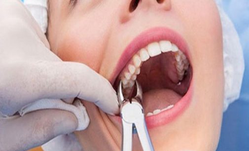 Koronavirüsün bir belirtisi daha ortaya çıktı: Ani diş kaybı