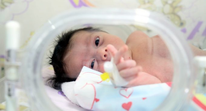 20 bin doğumda bir görülüyor: Arslan bebek tüm organları ters doğdu!