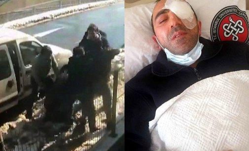 Avcılar’da belediye çalışanlarına saldırı: Belediye kameramanı yüzde 90 görme kaybına uğradı