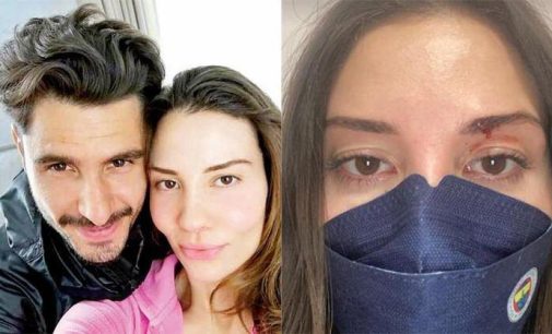 Futbolcu Özer Hurmacı’nın tehdit ettiği eşi kanlar içindeki halini paylaştı