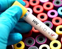 HIV virüsünde korkutan yeni varyant: Ölümcül ve hızlı yayılıyor