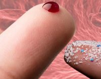 İnsan kanında ilk kez mikroplastiklere rastlandı