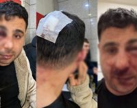 Polis aracında işkence: Gözaltına alan polisler tarafından darp edildi, kafasında bardak kırıldı