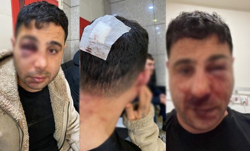 Polis aracında işkence: Gözaltına alan polisler tarafından darp edildi, kafasında bardak kırıldı