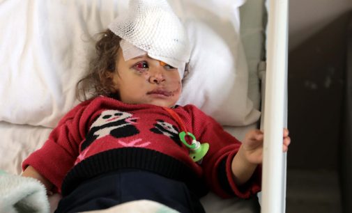 Eşeğin ısırdığı küçük Fatma’ya, boynundan alınan doku ile yeni göz kapağı yapıldı
